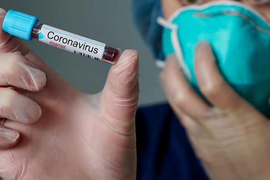 Gasparense testa positivo para coronavrus aps exame em laboratrio particular