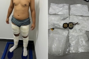 Jovem que tentava ir para Paris com drogas coladas no corpo  preso no Aeroporto de Navegantes