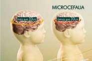 Microcefalia: estado de emergência