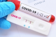 Ilhota soma 168 casos confirmados de coronavrus
