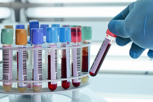 Hepatite misteriosa: novo caso suspeito  notificado em SC