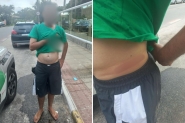 Homem leva pauladas de moradores aps tentar furtar carros em Florianpolis
