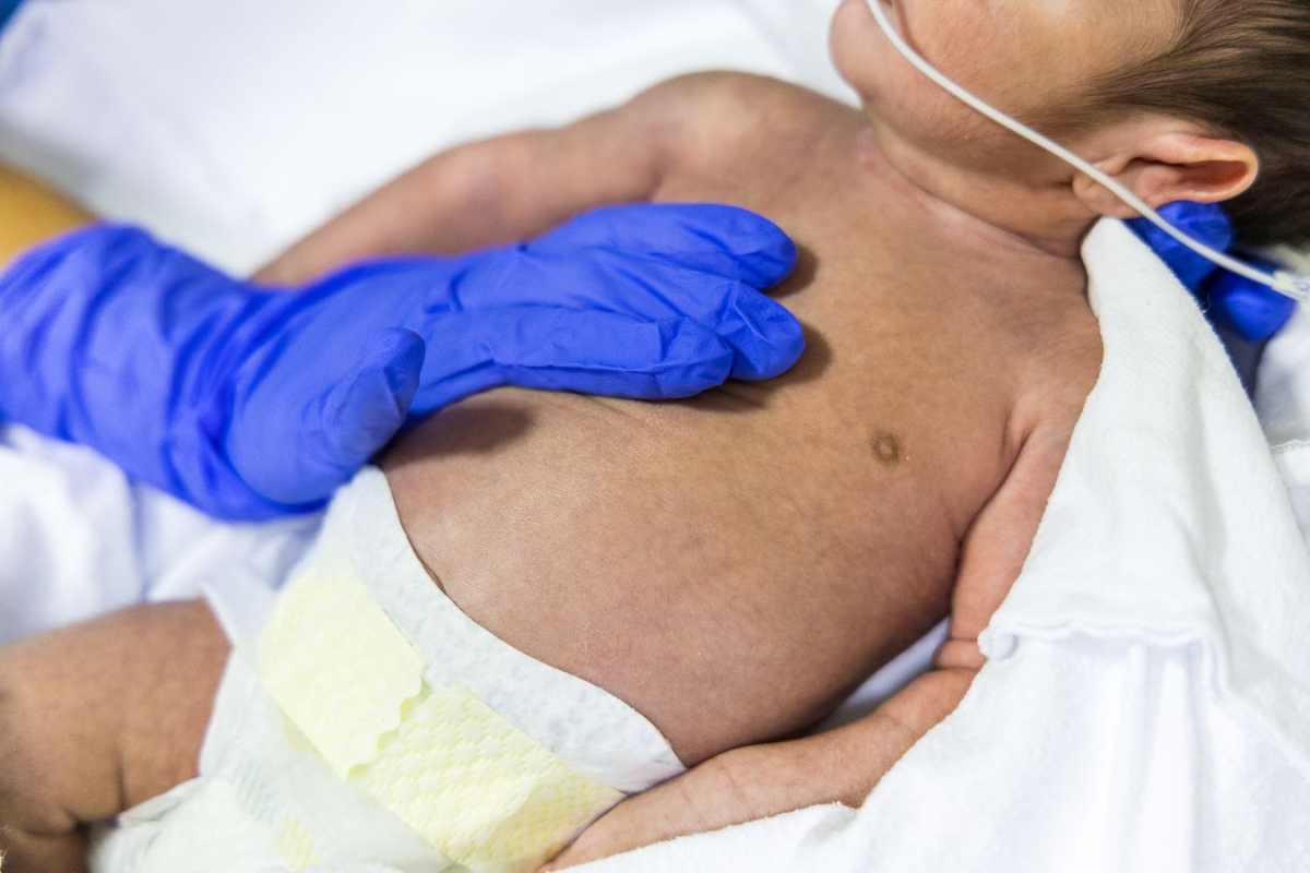 SC registra mais de dois mil casos de sndrome respiratria aguda grave em 2025