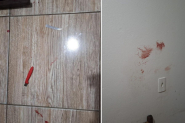 Homem n�o aceita fim do relacionamento e esfaqueia ex na cabe�a, peito, costas e m�o em Gaspar