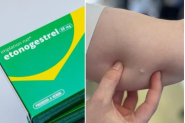Gaspar disponibiliza implante contraceptivo Implanon de forma gratuita